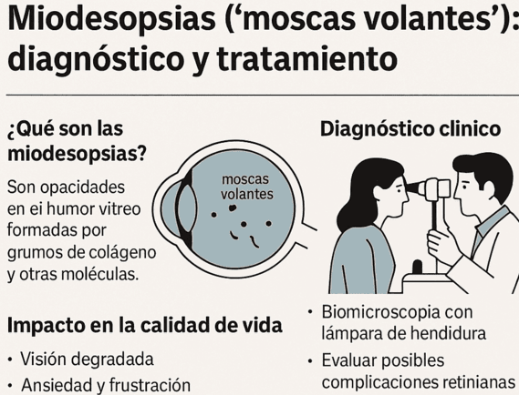 Miodesopsias (‘moscas volantes’): causas, diagnóstico y tratamiento