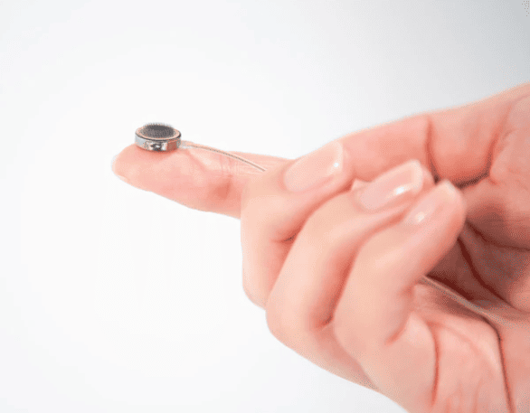 La nueva generación de implantes que promete devolver el habla. Interfaces cerebro-computadora.