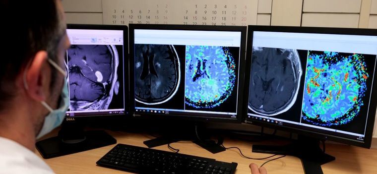 DISCERN es un avance importante en la detección precoz del cáncer Foto: Vall d’Hebron Instituto de Oncología