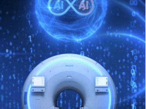 Philips y NVIDIA impulsan el futuro de la resonancia magnética con inteligencia artificial