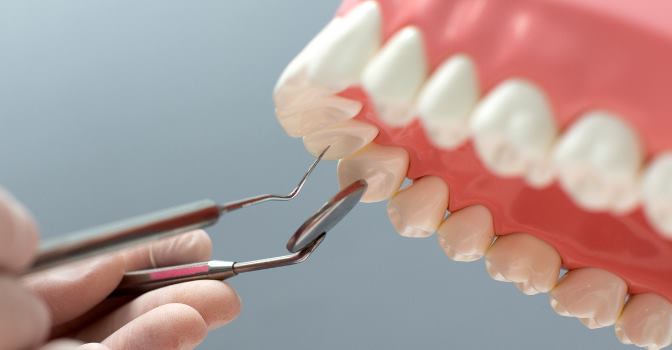 Consejos para evitar el edentulismo, la pérdida de piezas dentales por caída.