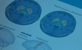 Investigadores del HM CINAC publican una teoría que cuestiona el origen periférico del Parkinson