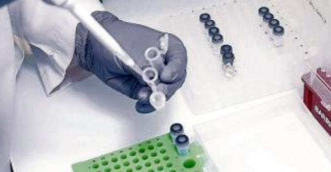 IMQ Igurco analizará las aguas residuales de sus centros para detectar coronavirus