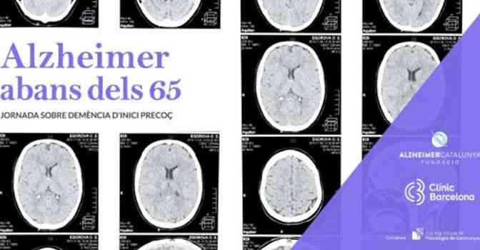 Una jornada aborda el Alzheimer en menores de 65 años.