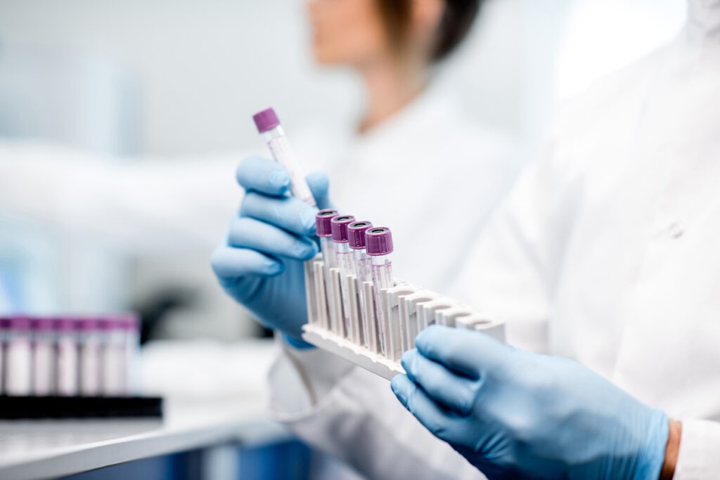 Análisis de sangre: ¿una nueva herramienta para detectar el Alzheimer?