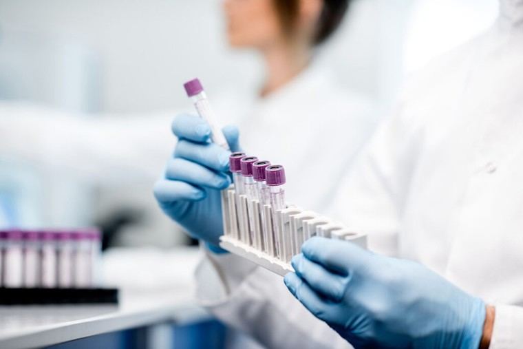 Análisis de sangre: ¿una nueva herramienta para detectar el Alzheimer?