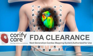 Revolución en cardiología: el chaleco inteligente que mapea el corazón de los mayores en minutos